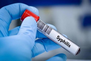 Foto de Preocupación por el brote de sífilis en Argentina: cifras récord en jóvenes y adultos