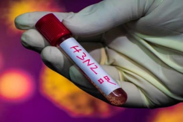 Foto de Confirman que la supergripe H3N2 lleg� a la Argentina: detectan tres infectados