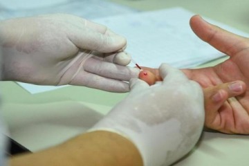 Foto de Argentina registr� un 71% m�s de casos de s�filis en 2025, la mayor cifra en 5 a�os