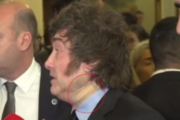 Foto de "Golpe en la ba�adera": el Gobierno explic� qu� le pas� a Milei en el cuello